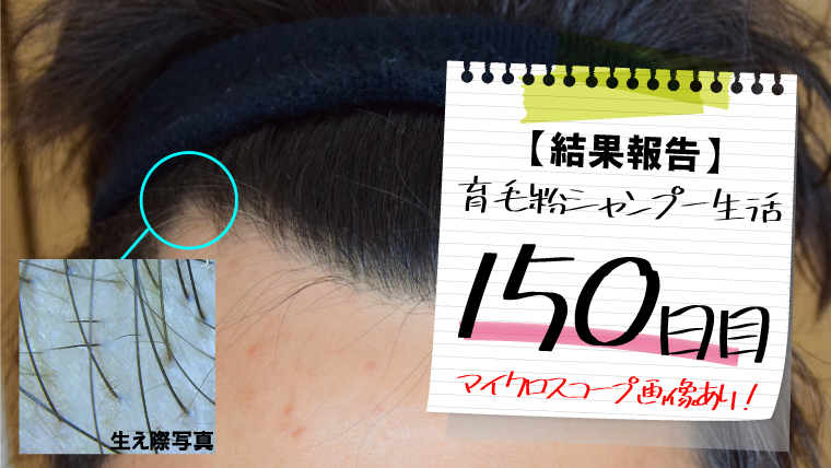 「粉シャンプーは効果なし説」はウソ！開始から150日目の効果（マイクロスコープ画像あり） 